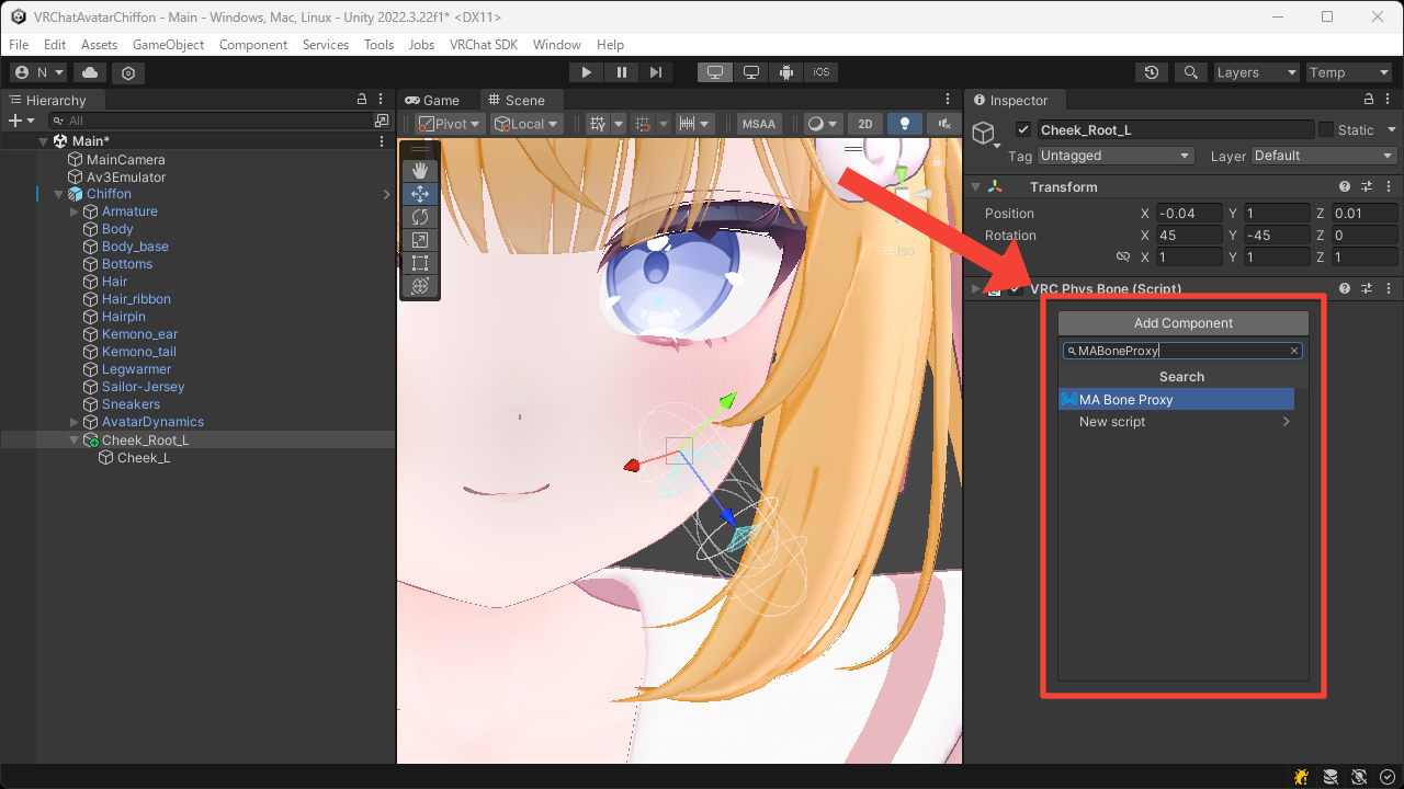 MA Bone Proxy の追加